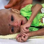 starved-child-in-Pakistan-there-is-no-god